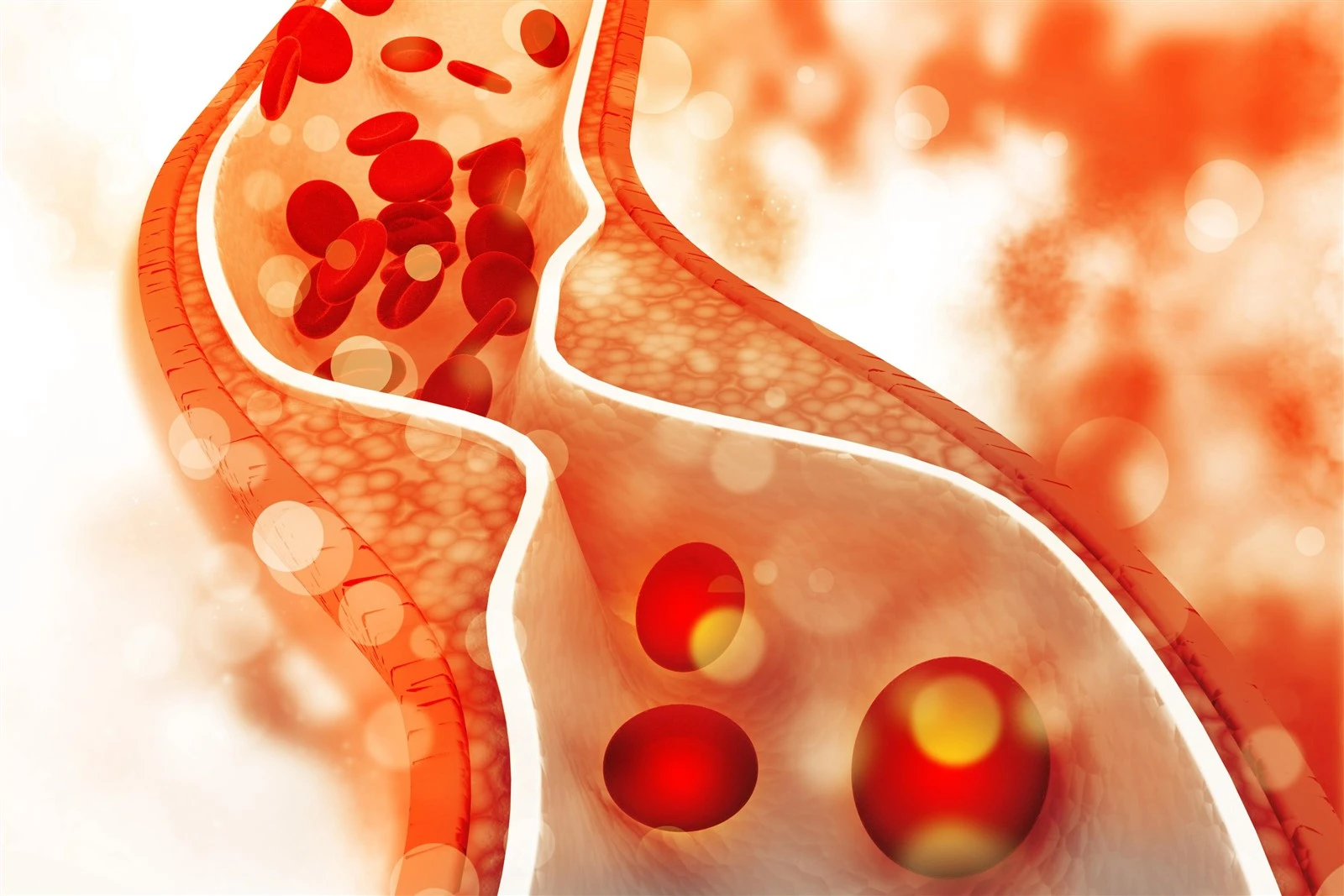 Cholesterol | Shaanxi BLOOM Tech Co., Ltd Cholesterol | Shaanxi BLOOM Tech Co., Ltd