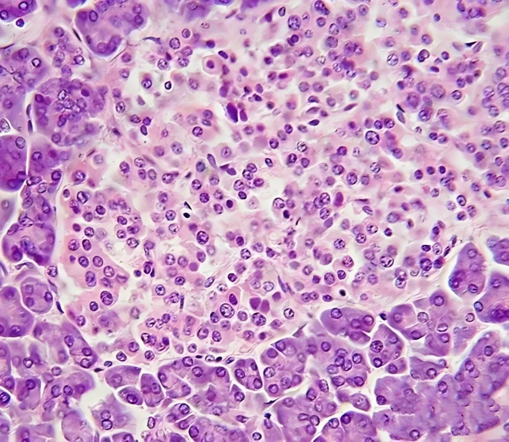 Bioglutide NA-931 Fewer | Shaanxi BLOOM Tech Co., Ltd Bioglutide NA-931 Fewer | Shaanxi BLOOM Tech Co., Ltd