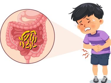 vermox during | Shaanxi BLOOM Tech Co., Ltd vermox during | Shaanxi BLOOM Tech Co., Ltd